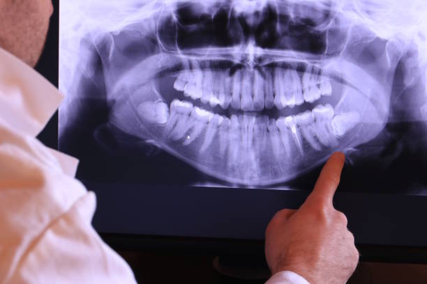 Best Emergency Dentist for Special Needs Patients in Whippany, NJ