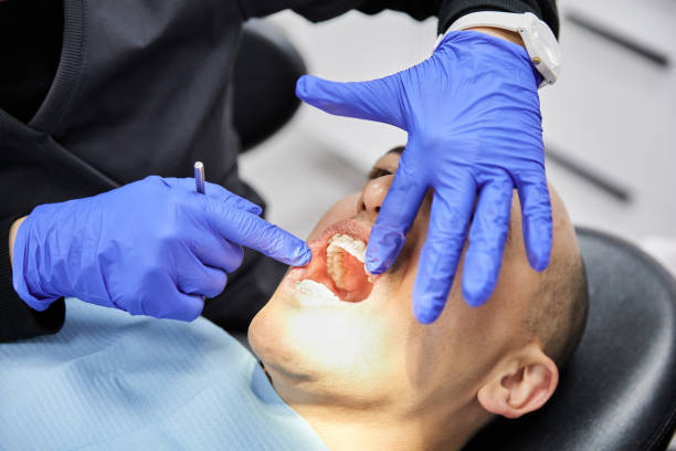 Best Emergency Dental Care for Abscessed Tooth in Whippany, NJ