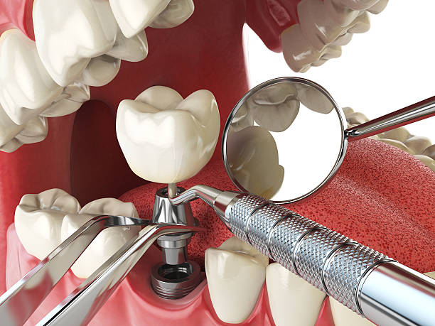 Best Emergency Cosmetic Dentistry in Whippany, NJ
